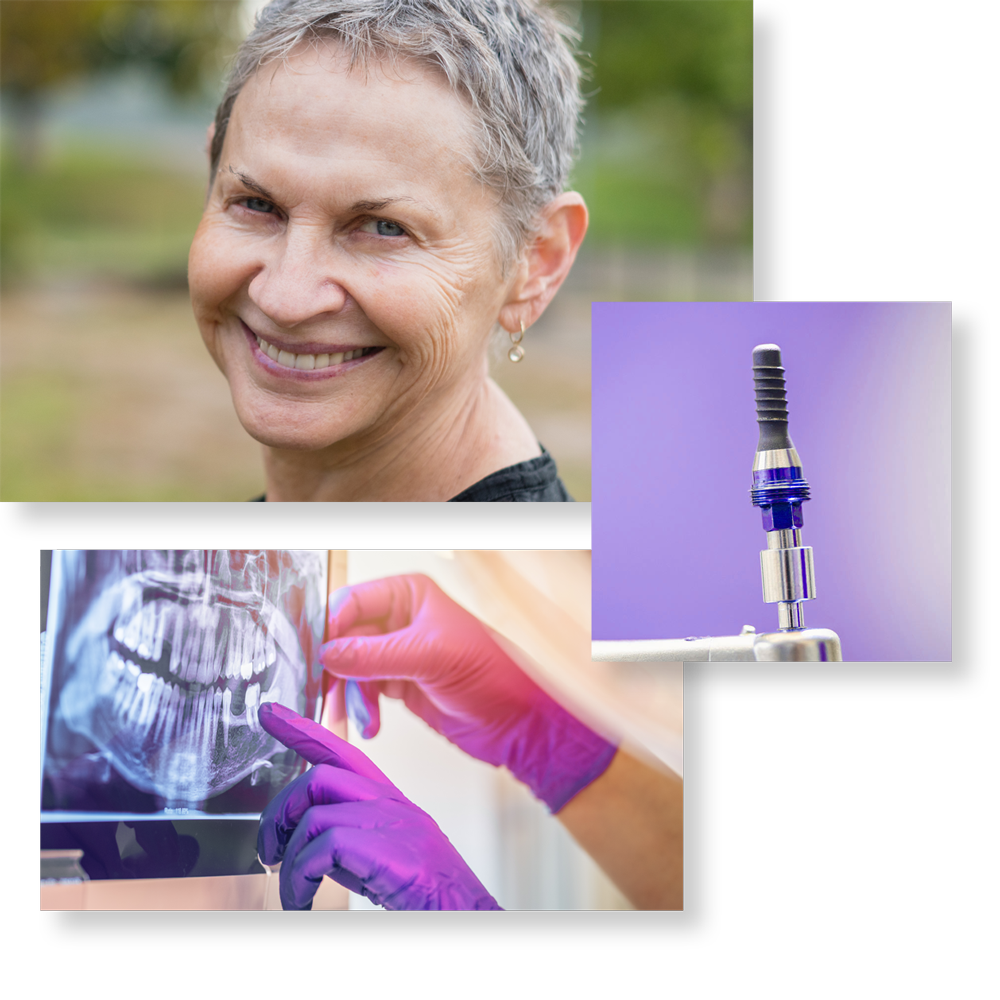 gallery images featuring an older woman with gorgeous smile and lipstick, an image of a dental implant with purple background, and a pair of gloved hands examining a dental x-ray