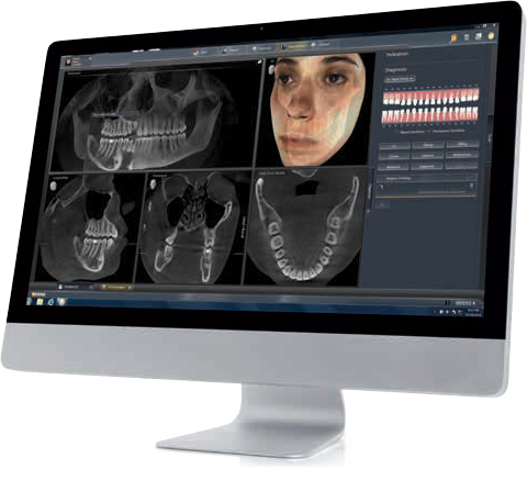 Dental software